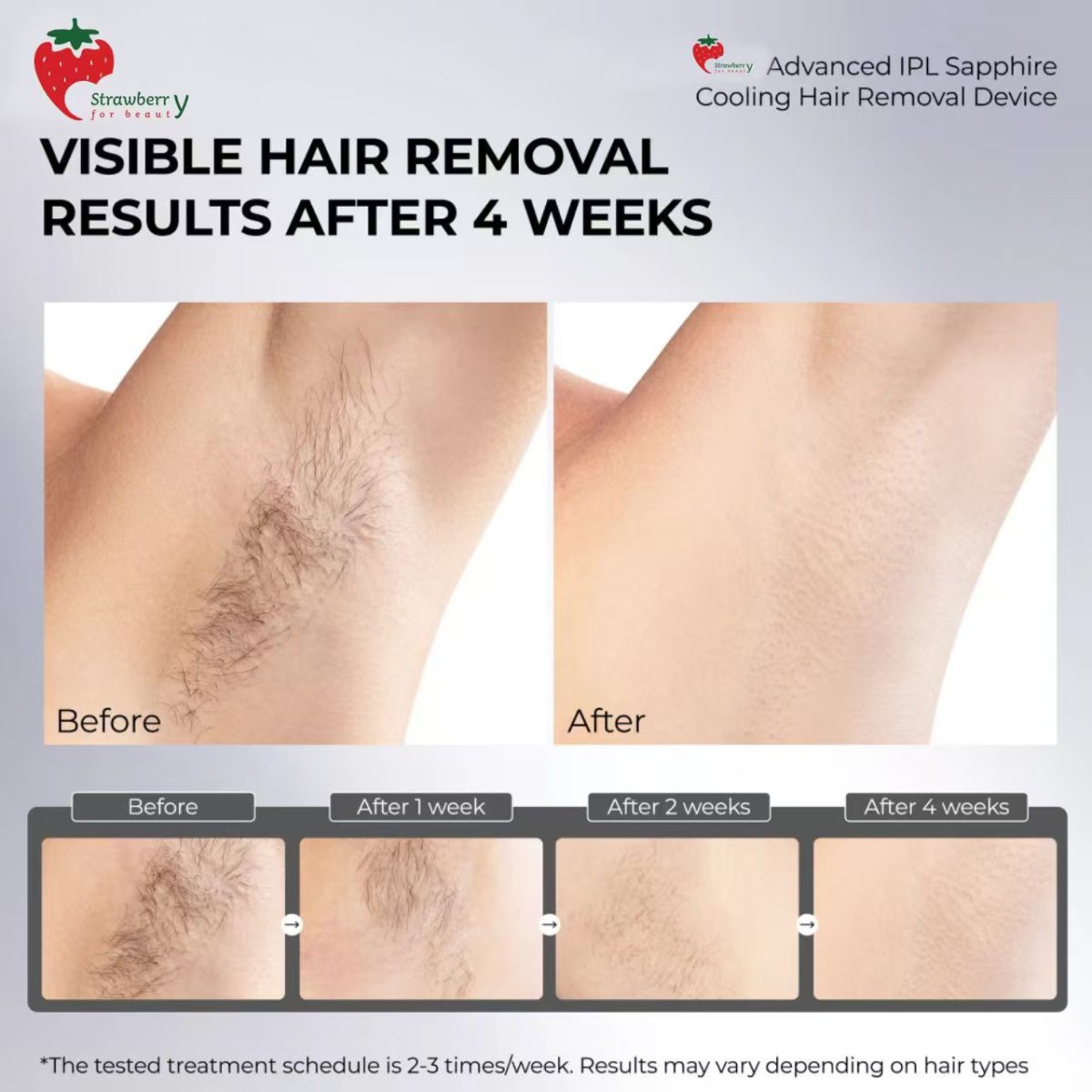 laser hair removal machine with sapphire ice cooling - Image 5