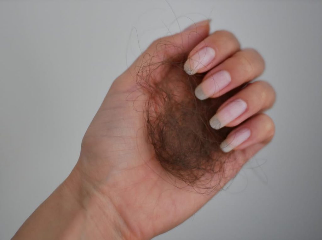 امرأة تمسك شعرًا متساقطًا — تساقط الشعر الإمارات 2026