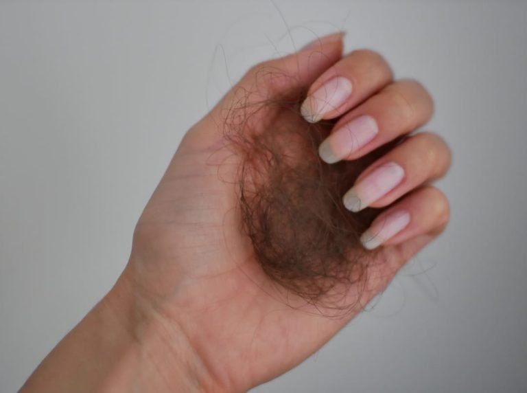 Causes of Hair Loss in the UAE 2026, and the Science-Backed Treatment